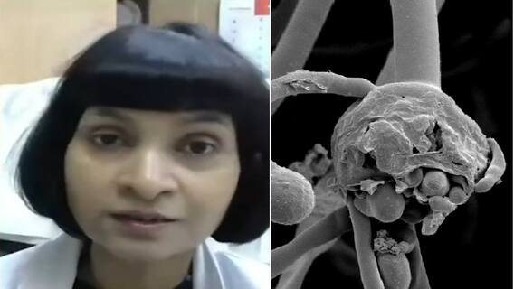 'Black Fungus संक्रामक नहीं है, छूने से नहीं फैलता'- Dr Padma Srivastava; जानिए अपने हर शंका का जवाब
