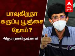 Health Secretary J. Radhakrishnan on black fungus: பரவுகிறதா கருப்பு பூஞ்சை நோய்?