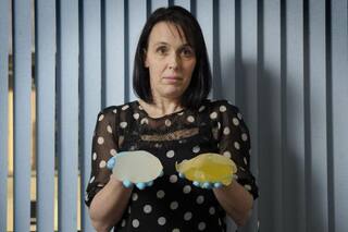 ‘ਬ੍ਰੈੱਸਟ ਇੰਪਲਾਂਟ’ ਦੀਆਂ 250 ਤੋਂ ਵੱਧ ਪੀੜਤਾਂ ਨੂੰ ਮਿਲੇਗਾ ਮੁਆਵਜ਼ਾ, ਅਦਾਲਤ ਨੇ ਸੁਣਾਇਆ ਵੱਡਾ ਫ਼ੈਸਲਾ