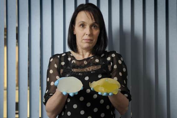 ‘ਬ੍ਰੈੱਸਟ ਇੰਪਲਾਂਟ’ ਦੀਆਂ 250 ਤੋਂ ਵੱਧ ਪੀੜਤਾਂ ਨੂੰ ਮਿਲੇਗਾ ਮੁਆਵਜ਼ਾ, ਅਦਾਲਤ ਨੇ ਸੁਣਾਇਆ ਵੱਡਾ ਫ਼ੈਸਲਾ