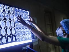 ब्लैक फंगस की रोकथाम के लिए बहुत अहम हैं ये तीन चीजें, AIIMS के डायरेक्टर रणदीप गुलेरिया ने जानें क्या कहा?