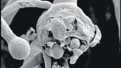 Black Fungus: করোনার মতো এবার ব্ল্যাক ফাঙ্গাসকেও মহামারী ঘোষণা করল কেন্দ্র