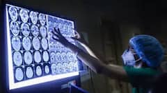 મ્યુકરમાઇકોસિસ કેવા લોકોને થઇ શકે છે? મ્યુકરમાઇકોસિસ થવા પાછળના શું છે કારણો?