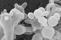 બ્લેક ફંગસ બાદ વ્હાઇટ ફંગસે ઉંચક્યું માથું, જાણો કેટલી ખતરનાક છે આ બીમારી અને શું છે તેના સાંકેતિક લક્ષણો?