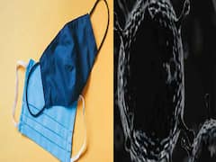 Mucormycosis : तुमचा मास्क बनू शकतो का ब्लॅक फंगसचं कारण? एक्सपर्ट काय सांगतात?