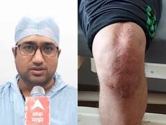 गुडघ्यावरील शस्त्रक्रियेची जागतिक स्तरावर नोंद, मनमाडच्या डॉ. फहिम कुरेशींच्या सर्जरीची दखल