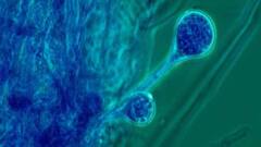 আজ বাংলায়: রাজ্যে ফের ব্ল্যাক ফাঙ্গাসে আক্রান্ত হয়ে মৃত্যু এক রোগীর