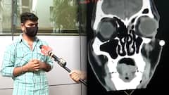 Black Fungus: Why medicines are still not available in Mumbai? | Ground Report