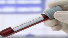 જાણો શું હોય છે CRP ટેસ્ટ, કોરોના પોઝિટિવ લોકો માટે શા માટે જરૂરી છે?