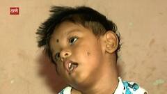 ठाण्यातील प्रियांश वीरकरची दुर्धर आजारासोबत झुंज, 20 महिन्याच्या लेकराला तुमच्या मदतीची गरज