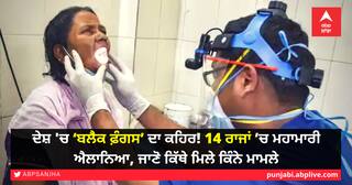 ਦੇਸ਼ 'ਚ ‘ਬਲੈਕ ਫ਼ੰਗਸ’ ਦਾ ਕਹਿਰ! 14 ਰਾਜਾਂ ’ਚ ਮਹਾਮਾਰੀ ਐਲਾਨਿਆ, ਜਾਣੋ ਕਿੱਥੇ ਮਿਲੇ ਕਿੰਨੇ ਮਾਮਲੇ