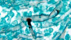 म्युकरमायकोसिस झालेल्या कुटुंबाची कहाणी, रुग्ण बरा होईल पण आयुष्यभराची कमाई जाते : स्पेशल रिपोर्ट