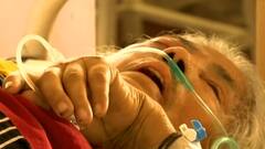 कोरोना के बाद अब फंगस से सहमे लोग, अब Yellow फंगस की एंट्री