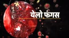 यहां मिला येलो फंगस का पहला मामला, जानिए आखिर है क्यों है ये खतरनाक!