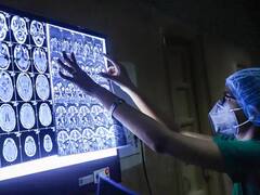 Black Fungus in UP: गैर कोरोना संक्रमित भी आ रहे हैं ब्लैक फंगस की चपेट में, पीजीआई में मिले दो रोगी