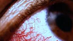 कोरोना से राहत मिलने लगी तो फंगस ने ले ली एंट्री, देश में 'ट्रिपल फंगस' का कहर