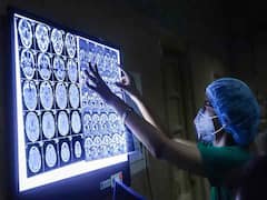 देश के 18 राज्यों में ब्लैक फंगस के 5424 मामले, गुजरात और महाराष्ट्र में सबसे ज्यादा