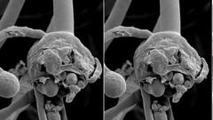 UP में तेजी से घट रहा Corona का ग्राफ, लेकिन कहर बरपा रहा 'Black Fungus' | Ganga Savera