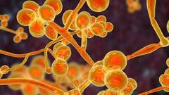 Yellow Fungus case in India: પહેલો કેસ આવ્યો સામે, શું છે તેના લક્ષણો, કારણો અને કઇ રીતે કરશો બચાવ જાણો