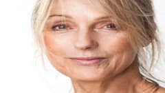 આ ઘરેલુ નુસખાથી અચૂક દૂર થશે ચહેરા પરની કરચલીઓ, કારગર છે ઉપાય, અપનાવી જુઓ