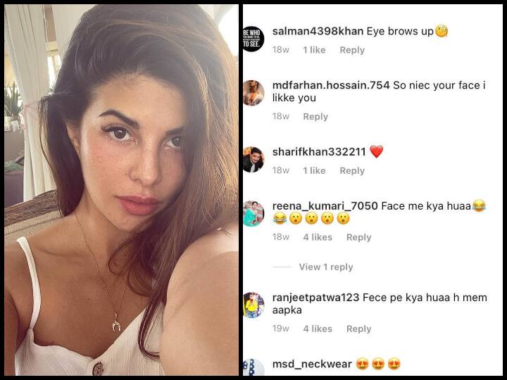 चेहर पर Freckles को देखकर कुछ लोगों ने पूछा कि आपके चेहरे पर क्या हुआ है? ऐसे बहुत सारे कमेंट देखने को मिले.