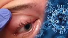 Mucormycosis : म्युकरमायकोसिसच्या रुग्णांना मोठा दिलासा, सरकारकडून शहरांच्या वर्गवारीनुसार उपचाराचे दर निश्चित