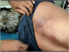 मवेशी चोरी के शक में 6 लोगों की जमकर पिटाई, 1 की हुई मौत; ग्राम प्रधान समेत छह लोग गिरफ्तार