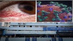 Mucormycosis: রামপুরহাটে মিউকরমাইকোসিসে আক্রান্ত হয়ে বৃদ্ধার মৃত্যু