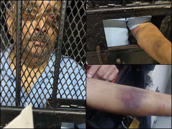 First Images Of Fugitive Mehul Choksi From Dominica Prison; Eyes Red, Bruises On Arm | See Pictures