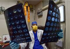 Black Fungus वरील उपचारांसाठी IIT Hyderabad कडून ओरल सॉल्यूशनची निर्मिती, किंमत केवळ 200 रुपये!