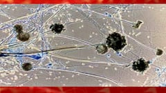 Mucormycosis: রাজ্যে ফের ব্ল্যাক ফাঙ্গাসে আক্রান্ত হয়ে মৃত্যু!