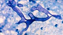 Mucormycosis: বাড়ছে উদ্বেগ, ব্ল্যাক ফাঙ্গাসে আক্রান্ত হয়ে রাজ্যে মৃত আরও ২