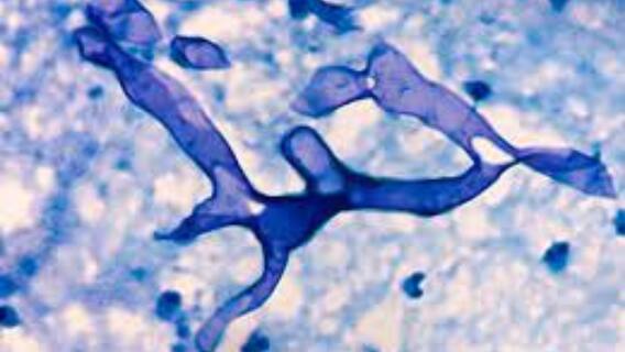 Mucormycosis: বাড়ছে উদ্বেগ, ব্ল্যাক ফাঙ্গাসে আক্রান্ত হয়ে রাজ্যে মৃত আরও ২