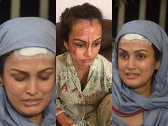 In Pics: सिर पर लगी चोट के साथ पति करण को सबक सिखाने निकलीं निशा रावल, Extramarital Affair समेत लगाए ये इल्जाम
