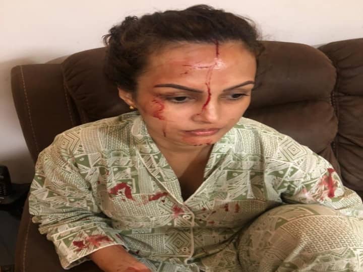 Nisha rawal friends shared her shocking picture wrote time to break the silence Nisha rawal के दोस्तों ने शेयर की उनकी चौंका देने वाली तस्वीर, लिखा- अब चुप्पी तोड़ने का समय है