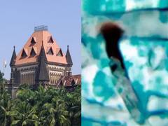 Mucormycosis : प्रशासनाने आता म्युकरमायकोसिसवर लक्ष केंद्रीत करावं : हायकोर्ट