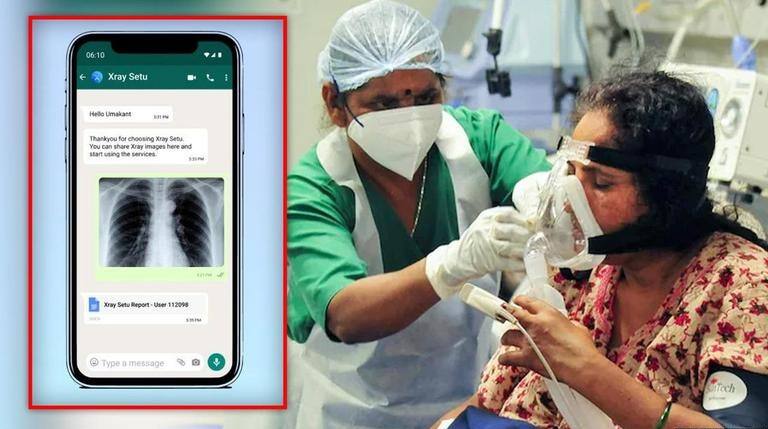 ਪਿੰਡਾਂ ਤੇ ਸ਼ਹਿਰਾਂ ’ਚ ਨਵੀਂ ਸਰਕਾਰੀ ਐਪ ‘ਐਕਸਰੇਅ ਸੇਤੂ’ ਇੰਝ ਰੋਕੇਗੀ ਮਹਾਮਾਰੀ ਦੀ ਰਫ਼ਤਾਰ New government Xray Setu app to stop epidemic in villages and cities ਪਿੰਡਾਂ ਤੇ ਸ਼ਹਿਰਾਂ ’ਚ ਨਵੀਂ ਸਰਕਾਰੀ ਐਪ ‘ਐਕਸਰੇਅ ਸੇਤੂ’ ਇੰਝ ਰੋਕੇਗੀ ਮਹਾਮਾਰੀ ਦੀ ਰਫ਼ਤਾਰ