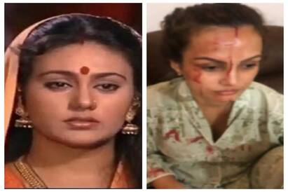 seeing the wound on nisha rawal face dipika chikhila said the marks are telling the truth Nisha Rawalના ચહેરાના ઘા જોઇને રામાયણની સીતા, દિપીકા ચીખલિયાએ કહ્યું કે... કરણે તેમને માર....