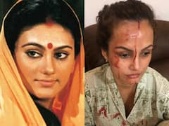 Nisha Rawal के चेहरे पर जख्म देख बोलीं 'रामायण' की सीता, कहा- निशान बता रहे हैं कि करन ने उसे मारा है...