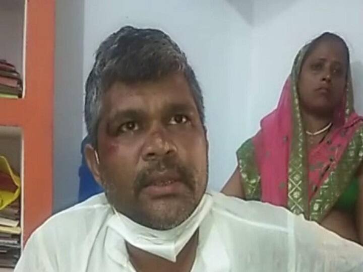 Bihar Crime: रंगदारी नहीं देने पर जेडीयू कार्यकर्ता की बेरहमी से पिटाई, दबंगों ने तोड़ डाली टांग