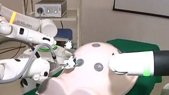मराठवाड्यात पहिल्यांदाच 'रोबोटिक सर्जरी', मानवी अवयवांवर रोबोटकडून शस्त्रक्रिया