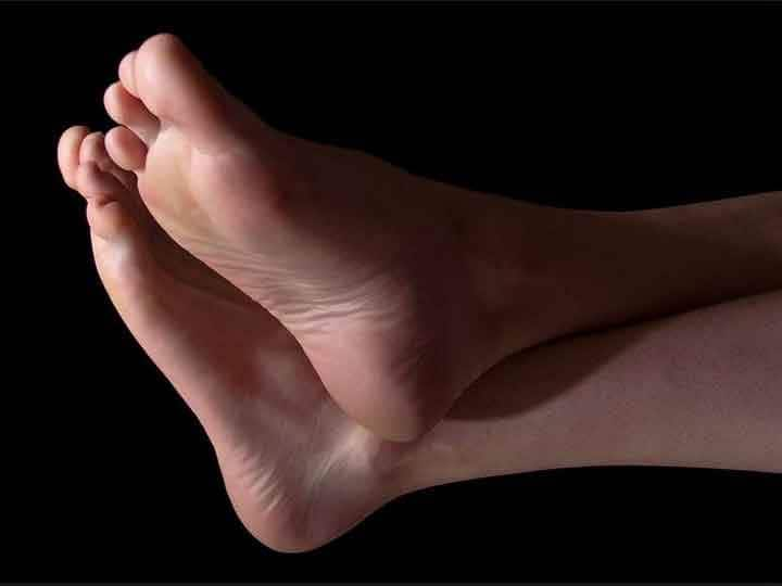 Cracked Heels Vitamin Deficiency, Crack Heels Home Remedies एड़ी फटने का मतलब शरीर में है इन 3 विटामिन की कमी, जानिए इलाज