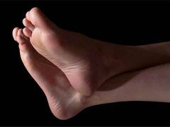 एड़ी फटने का मतलब शरीर में है इन 3 विटामिन की कमी, जानिए इलाज