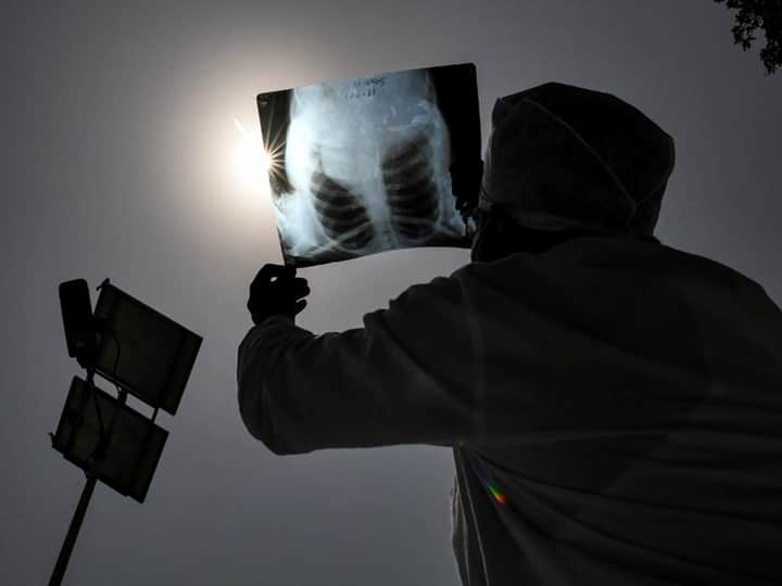 A Hindu devotees observes an annular solar eclipse through a X-Ray film at Durgiana Temple in Amritsar on June 21, 2020. (NARINDER NANU / AFP)