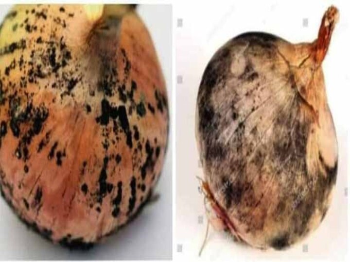 Mucormycosis Factcheck | வெங்காயத்திலிருந்து கருப்பு பூஞ்சை பரவுமா? ஃப்ரிட்ஜில் தென்படும் பூஞ்சை ஆபத்தானதா? உண்மை என்ன?