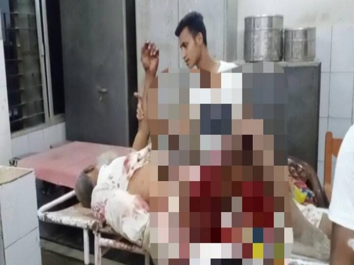 Bihar: Bomb blast in Araria, man seriously injured, two live bombs recovered from the spot ann बिहार: अररिया में बम विस्फोट, शख्स गंभीर रूप से घायल, मौके से दो जिंदा बम बरामद