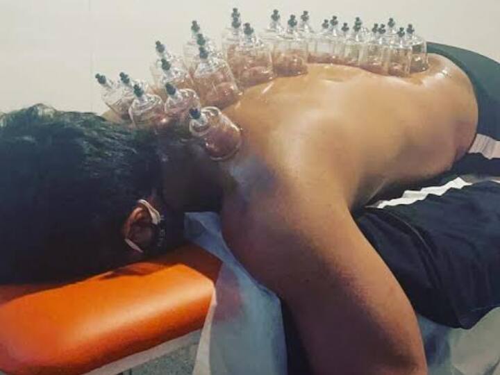Famous Kollywood actor Vishnu Vishal undergone cupping therapy pictures gone viral Vishnu Vishal Cupping Therapy  | கப்பிங் சிகிச்சை எடுத்துக்கொண்ட விஷ்ணு விஷால் : வைரலாகும் புகைப்படங்கள்..!