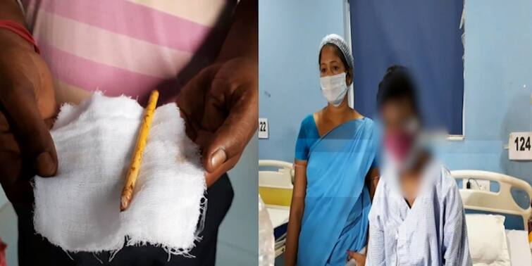 Sabang Teen boy gets relief after pen taken out from his anus by operating Sabang Teen Boy : ৫ মাস মলদ্বারে আটকে ছিল কলম ! সফল অস্ত্রোপচারে স্বস্তি সবংয়ের কিশোরের