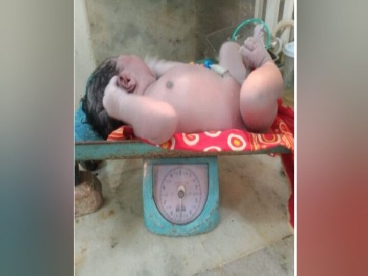 Assam Newborn Baby : அசாமில் 5.2 கிலோ எடையுடன் பிறந்த ஆண் குழந்தை