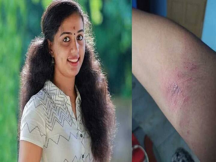 Vismaya's husband Kiran, accused of dowry harassment, surrenders day after her death அதிர்ச்சிதரும் வாட்சப் சாட்.. குடும்பத்தினரின் கதறல் : கேரள இளம்பெண் விஸ்மயாவின் கணவர் போலீஸில் சரண்..!